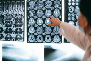 help of traumatic brain injury attorney