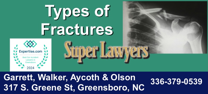 Types of fractures, fracture lawyer, fracture attorney, best fracture lawyer, best fracture attorney, broken bone